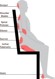 Diagram showing common pressure points along the body
